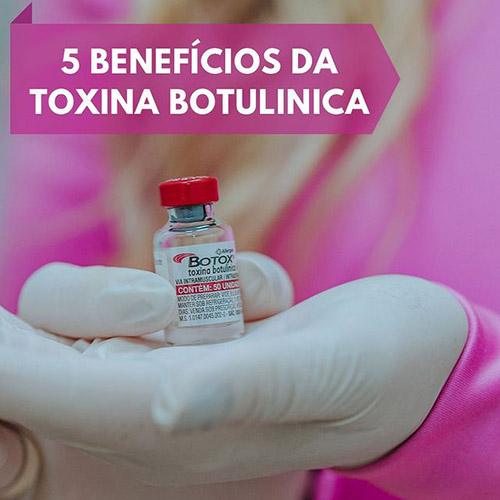 Benefícios da Toxina Butolinica